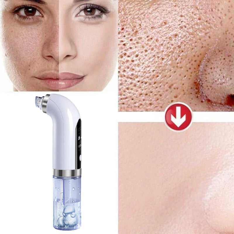 Proclean™️ | porentiefe, innovative Gesichtsreinigung