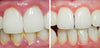 DentiCare™