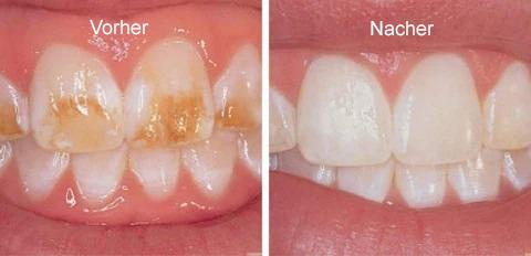 DentiCare™