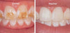 DentiCare™