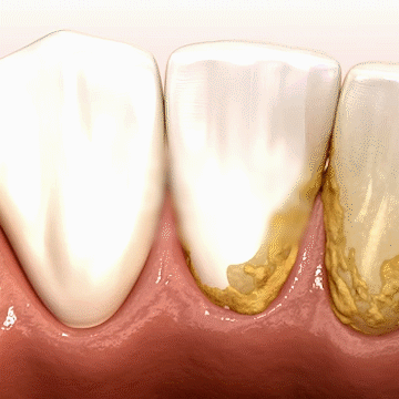 DentiCare™
