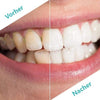 DentiCare™